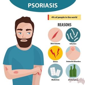 psoriasis1